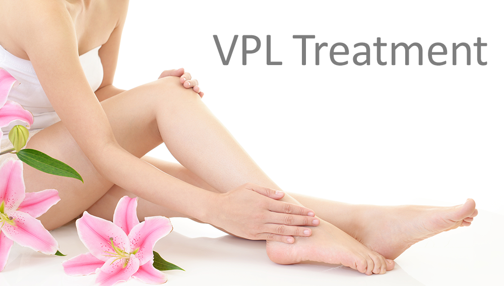VPL Treatment Singapore